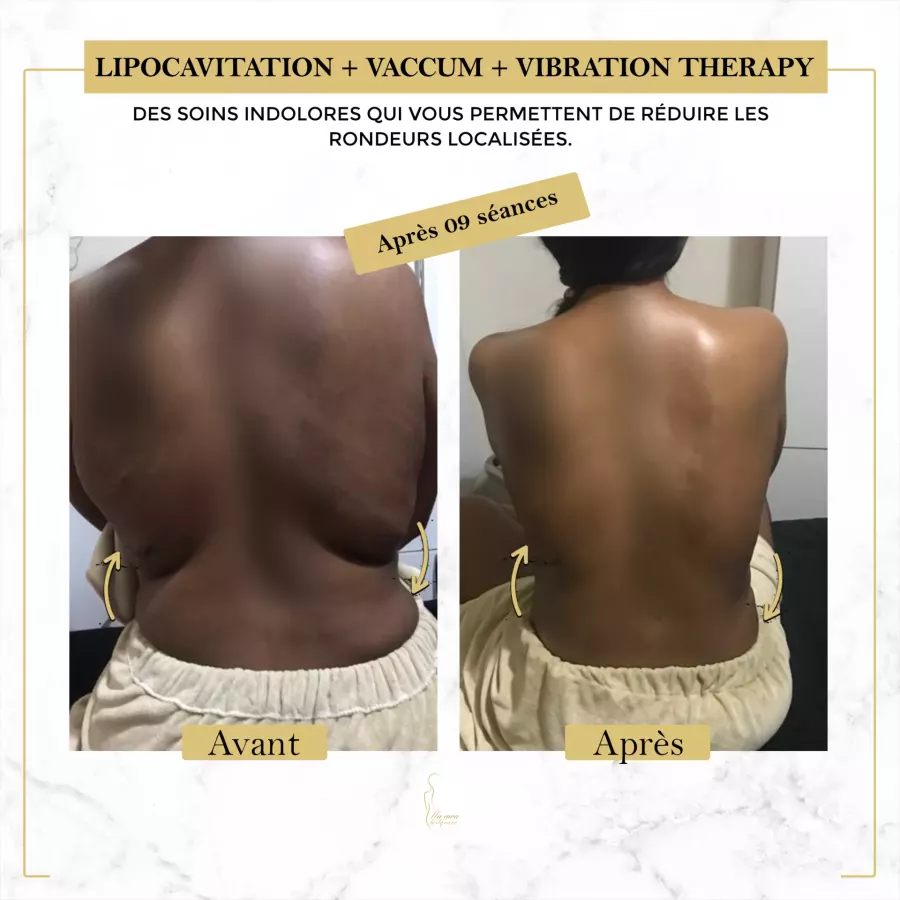 Maawa Body Care - SPA - Point E (Dakar)